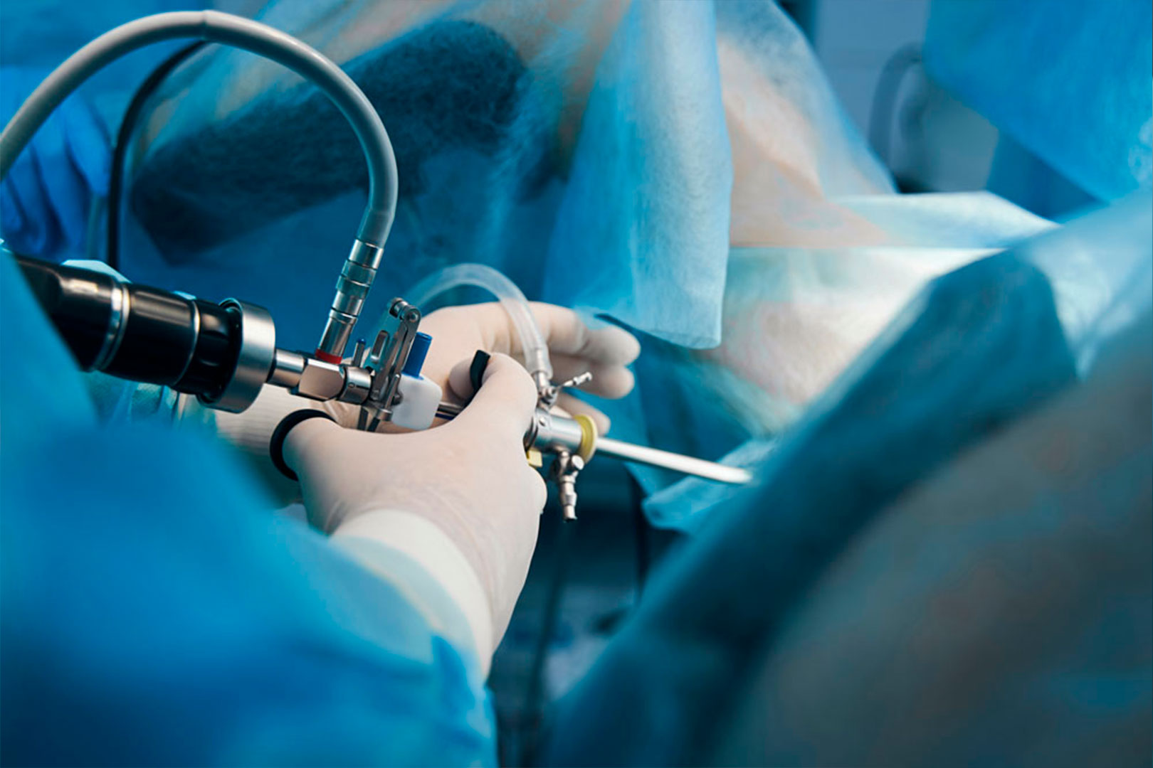 Colocación-de-catéter-doble-jota