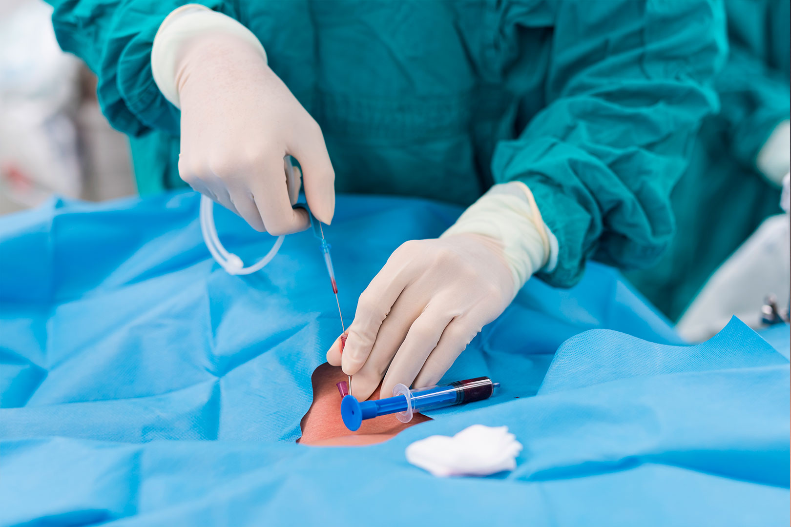 vesical-cistostomía