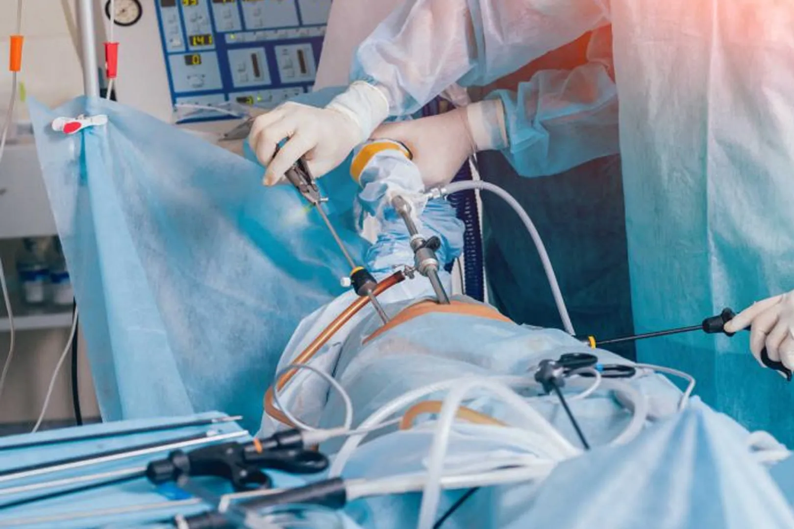 Prostatectomia-Radical-Laparoscopica-Robotica_11zon